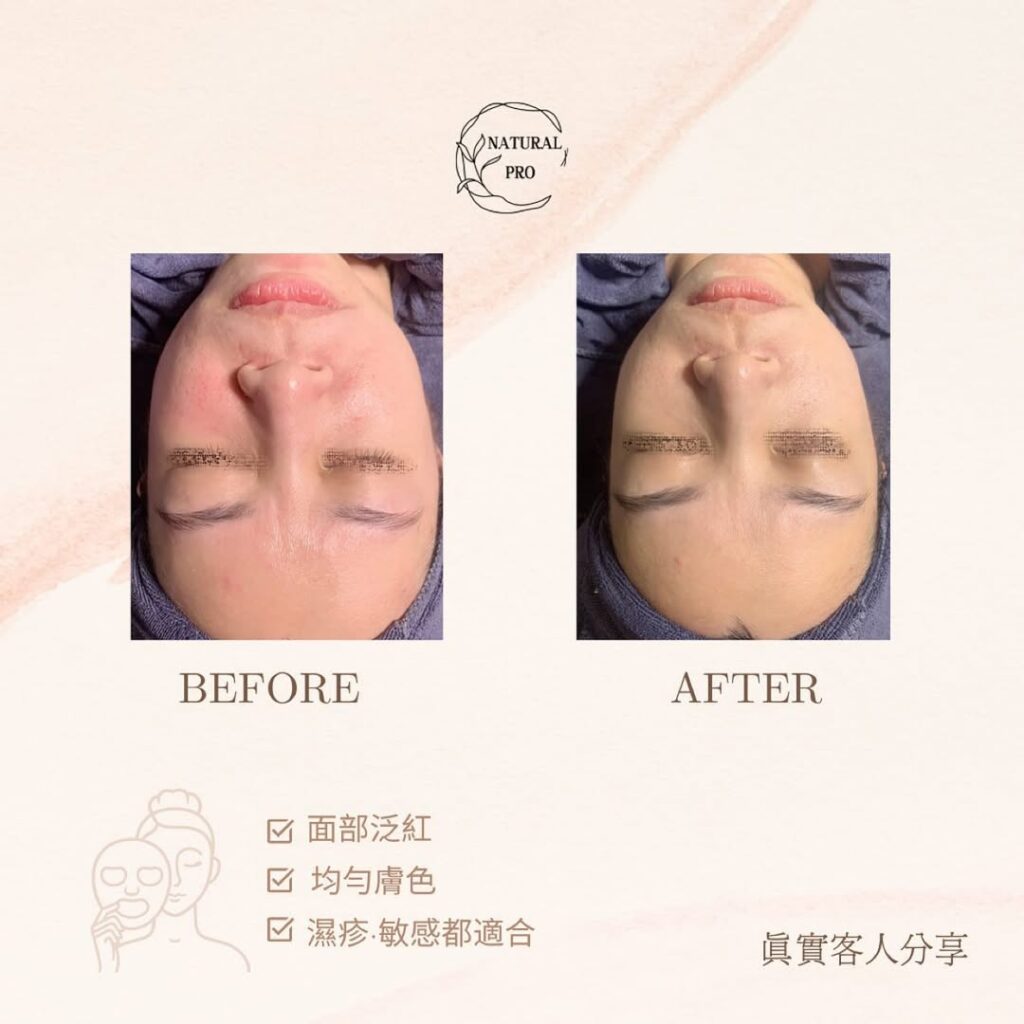 🥇店主5星推介🔥冰川水感肌（適合沙漠敏感肌、抗敏同時注入大量精華）💦 仲有放題式精華,你吸幾多我比幾多✅ 我哋所有療程都包針清收眉㗎😌 仲係💯單次收費 最緊要Relax💆🏼‍♀️｜預約需付訂金 先了解、後療程，請預留充足時間⏰ 絕無隱藏收費❌｜拒絕硬銷🙅🏼‍♀️ 賣的是經驗｜效果｜信譽