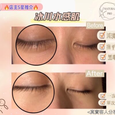 🥇店主5星推介🔥冰川水感肌（適合沙漠敏感肌、抗敏同時注入大量精華）