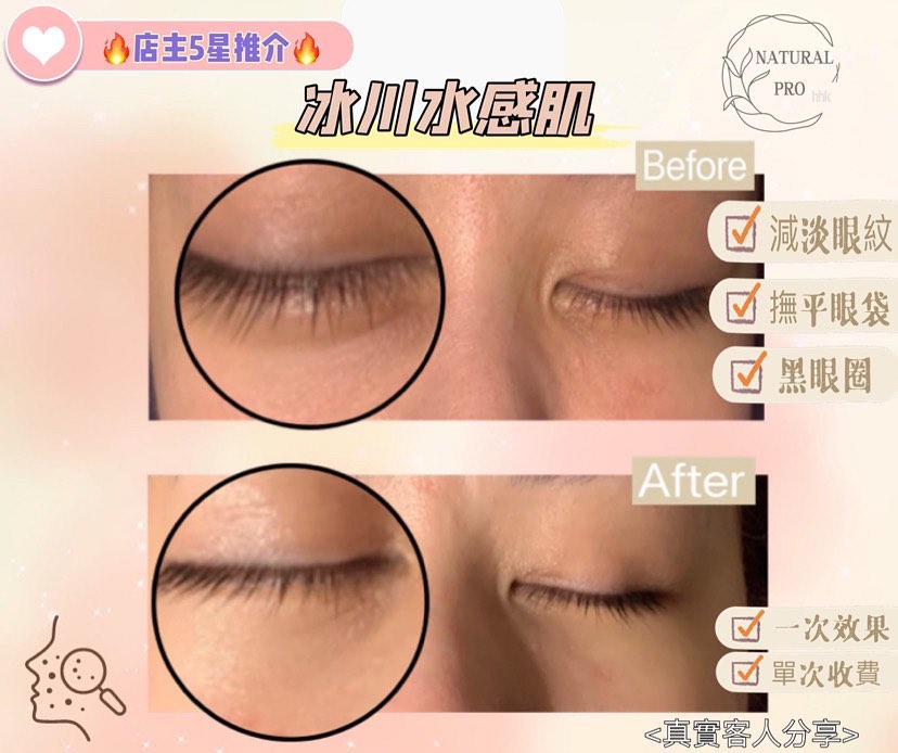 🥇店主5星推介🔥冰川水感肌（適合沙漠敏感肌、抗敏同時注入大量精華）